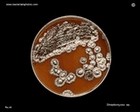 streptomyces on agar